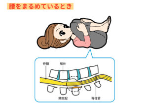 横浜 脊柱管狭窄症